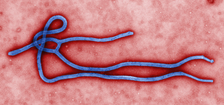 10/26 美国疫情更新：最致命埃博拉病毒卷土重来！美国机场开始筛查航班旅客